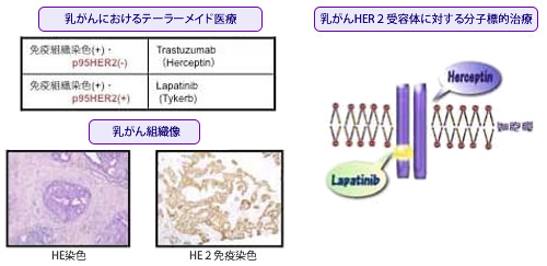 高度先進医療に関する説明画像