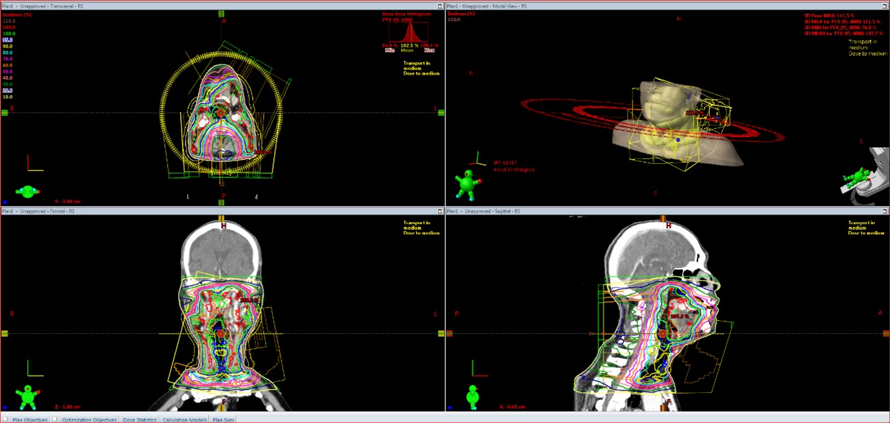 頭頸部がんIMRT
