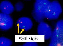 特殊な顕微鏡で染色体を観察している様子