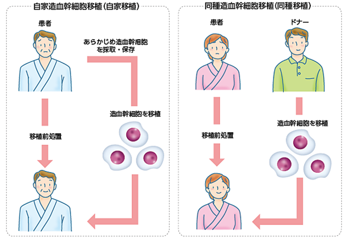 自家造血幹細胞移植（自家移植）、同種造血幹細胞移植（同種移植）