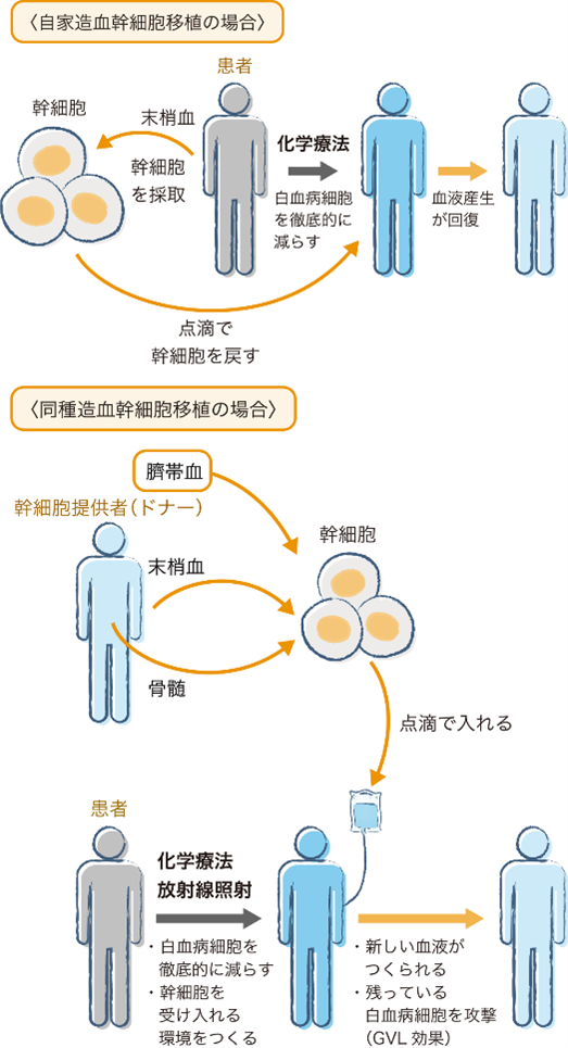 自家造血細胞移植の場合と同種造血幹細胞移植の場合