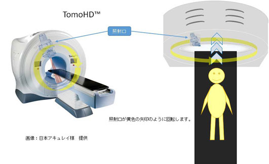 トモセラピーの説明図