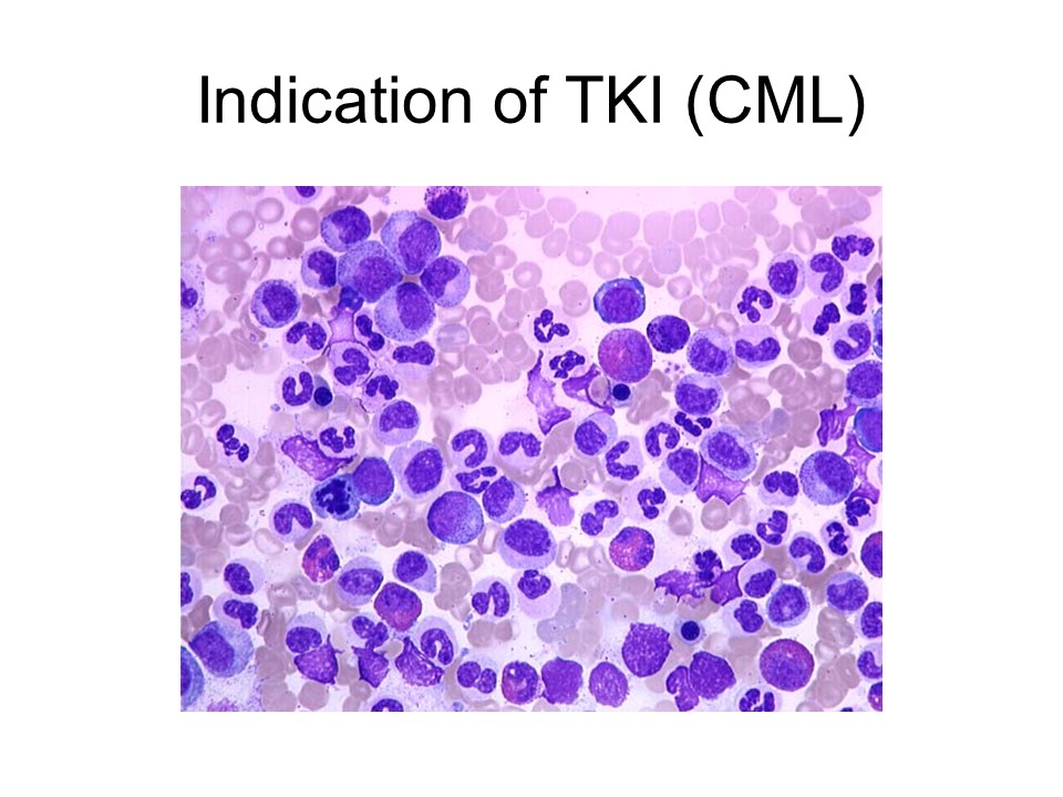 Indication of TKI（CML）