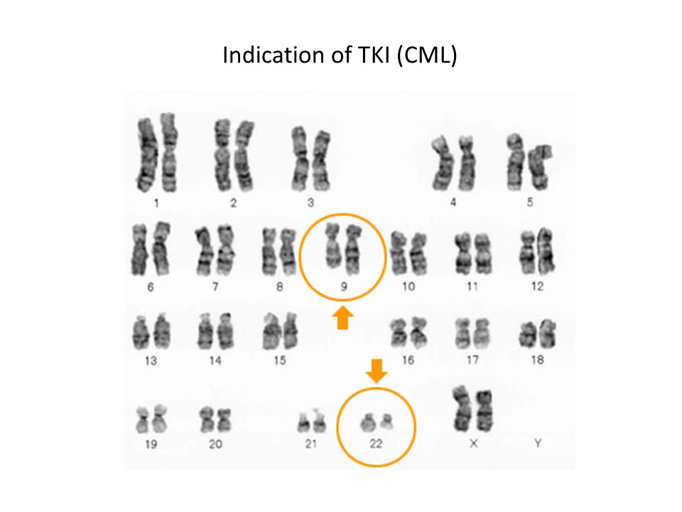 Indication of TKI（CML）